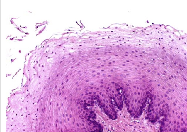 <p>several layers of</p><p>protects tissues </p><p>located in esophagus </p>