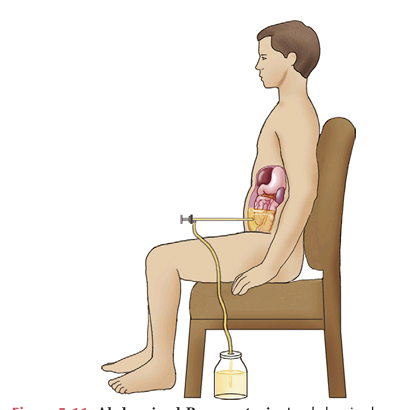 <p>IT is the procedure that is used to obtain a sample of pleural fluid for analysis. The fluid is assessed for each of the following characteristics</p>