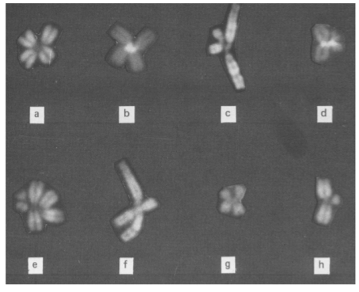 <p>! Hromosomu centromēru veidotās asociācijas: 1/1(a,b),1/16(c, d),1/1/16(e), 1/9(f), 16/16(g), 1/16p (h)</p><p>tās hromosomas, kuras hipometilētas, veido savdabīgas struktūras (tiek izjaukta normāla gēnu ekspresija)</p>