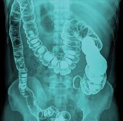<p>Barium studies</p>
