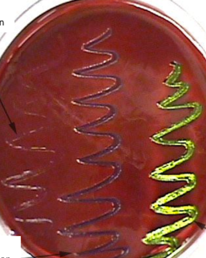 <p><span><strong><span>Eosin Methylene Blue Agar (EMB)</span></strong></span></p>