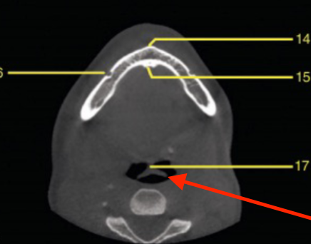 <p>identify the structure </p>