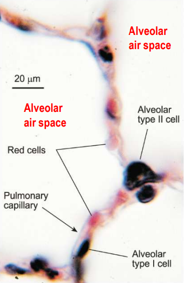 <p>• Lungs are not used for gas exchange during foetal life but must produce surfactant to be ready to breathe air at birth </p><p>• Alveolar epithelial Type II cells secrete surfactant to reduce surface tension </p><p>• Type-II cells mature fully in late pregnancy (wk 36) </p><p>• Premature babies can develop respiratory distress syndrome </p><p>• Alveolar epithelial Type I cells exchange gasses (02 and CO2 )</p>