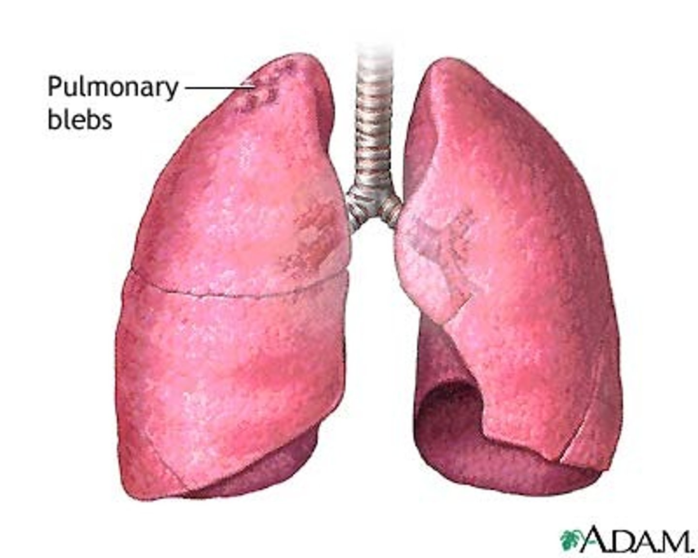 <p>Bleb</p>