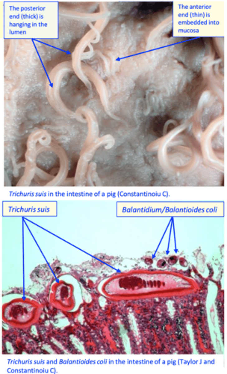 <p>• Visualization of the worms is relatively easy; • Histopathology;</p>