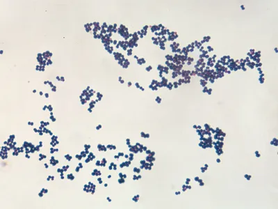 <p>what is this bacteria?</p>