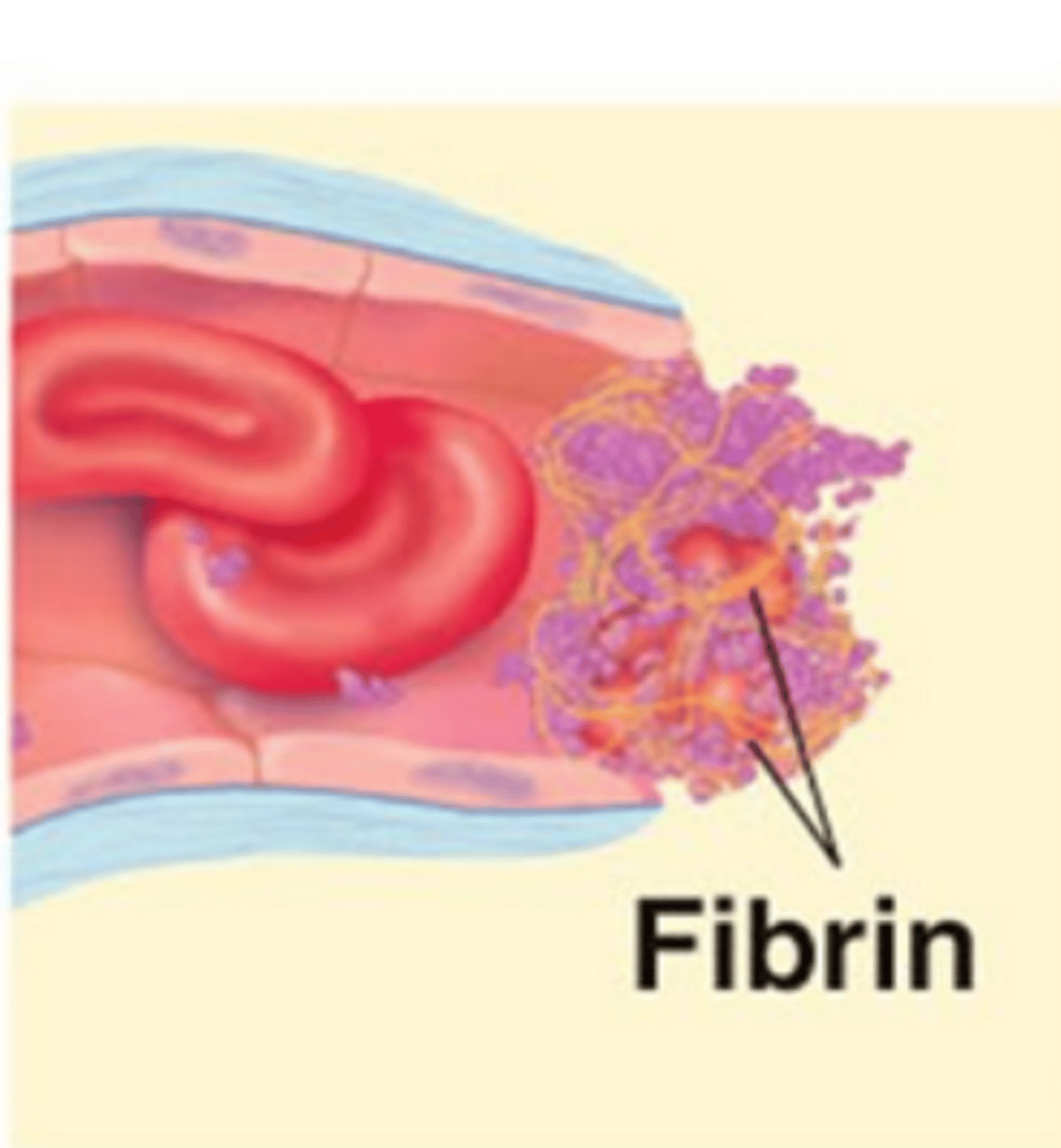 <p>Process in which a clot forms</p>
