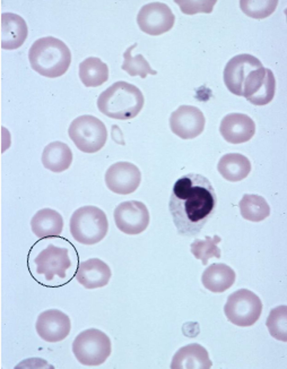 <p>describe the rbc</p>