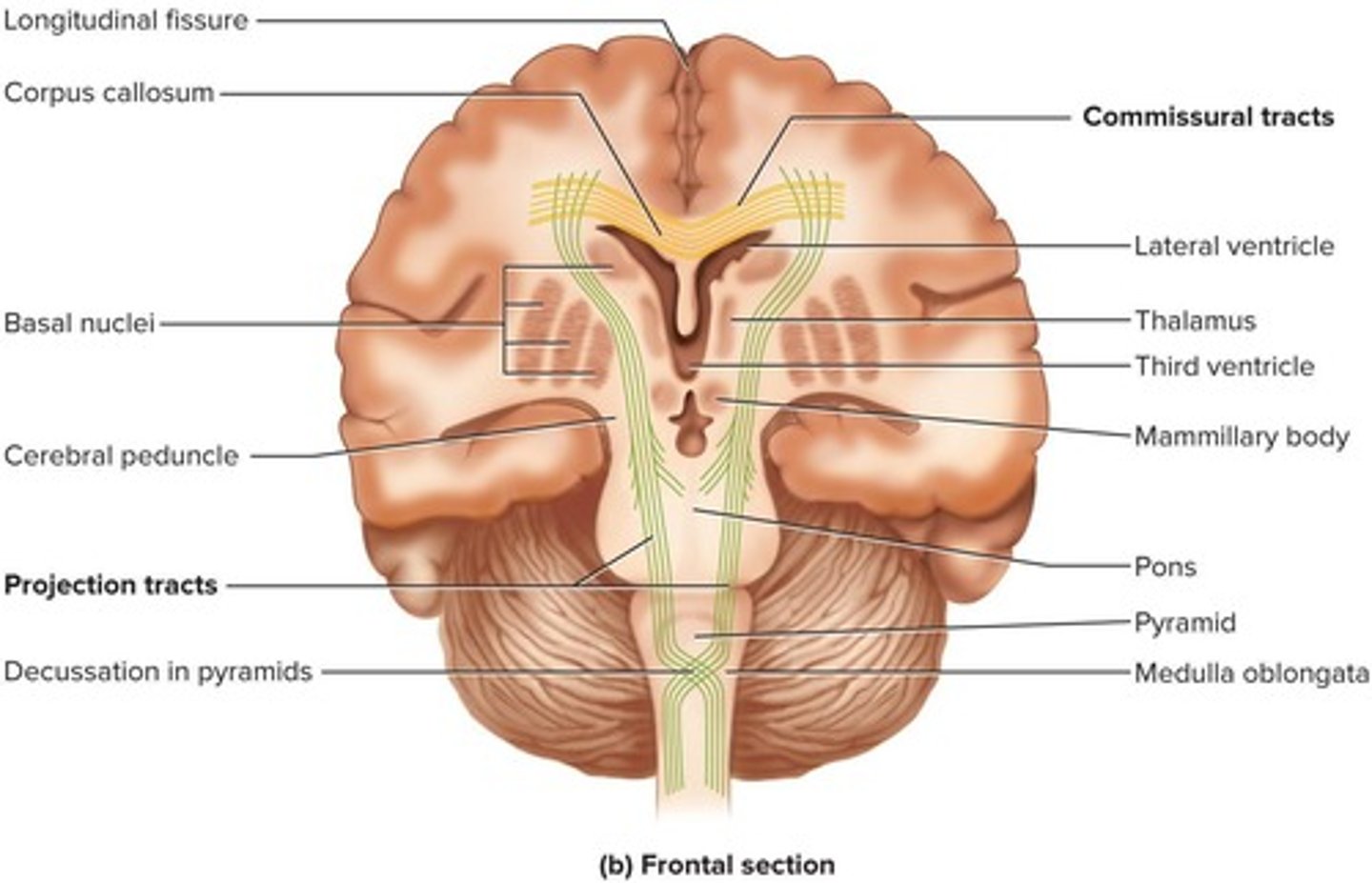 <p>The corpus callosum, a white fibrous tract.</p>