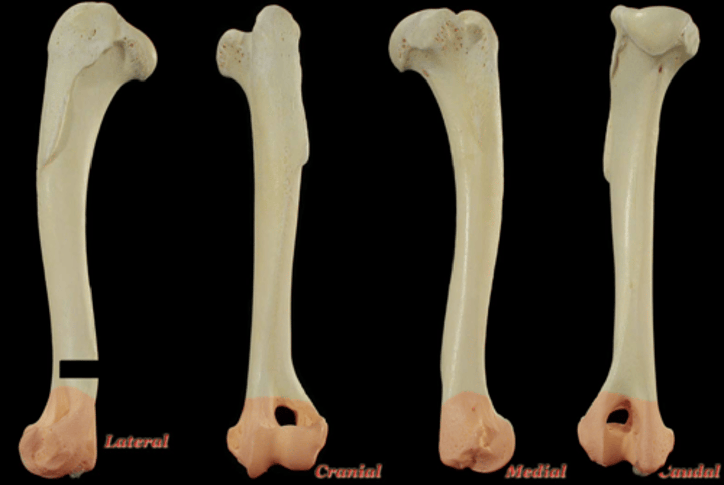 <p>What structure is highlighted in the picture?</p>