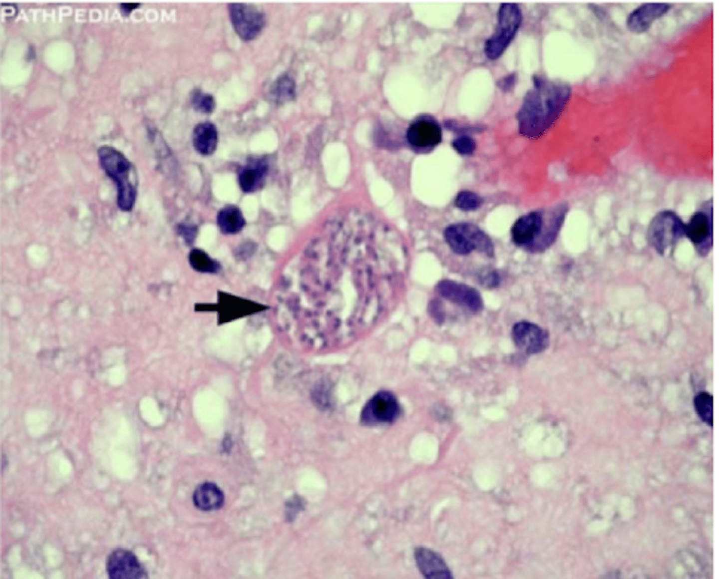 <p>muestras:</p><p>- corderos muertos</p><p>- placentas</p><p>IHQ</p><p>serología → IgG, IgM</p><p>PCR</p>