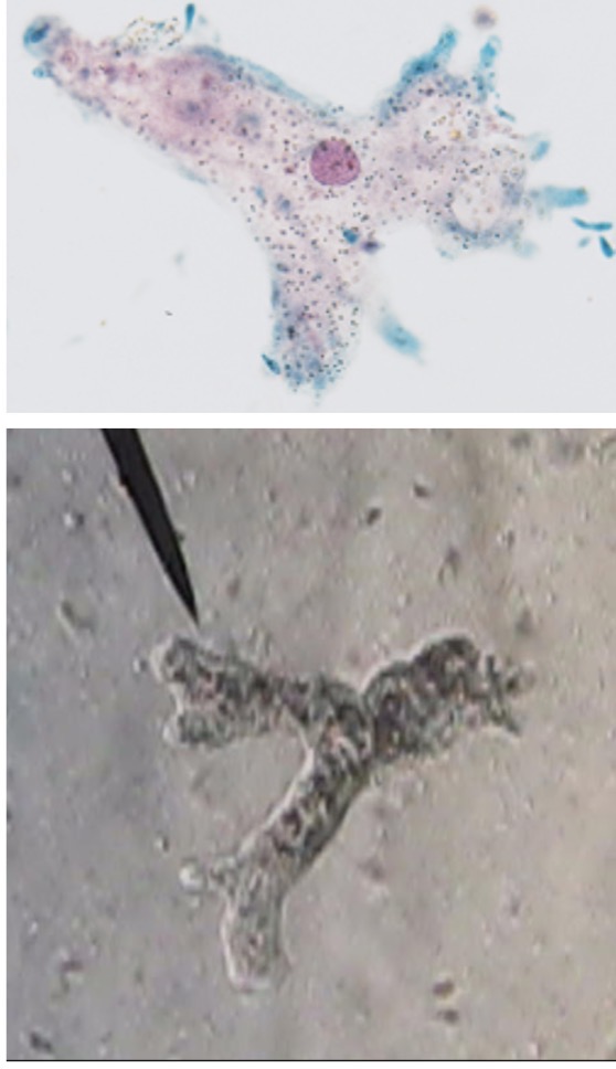 <p>Identify the gymnamoebas</p>