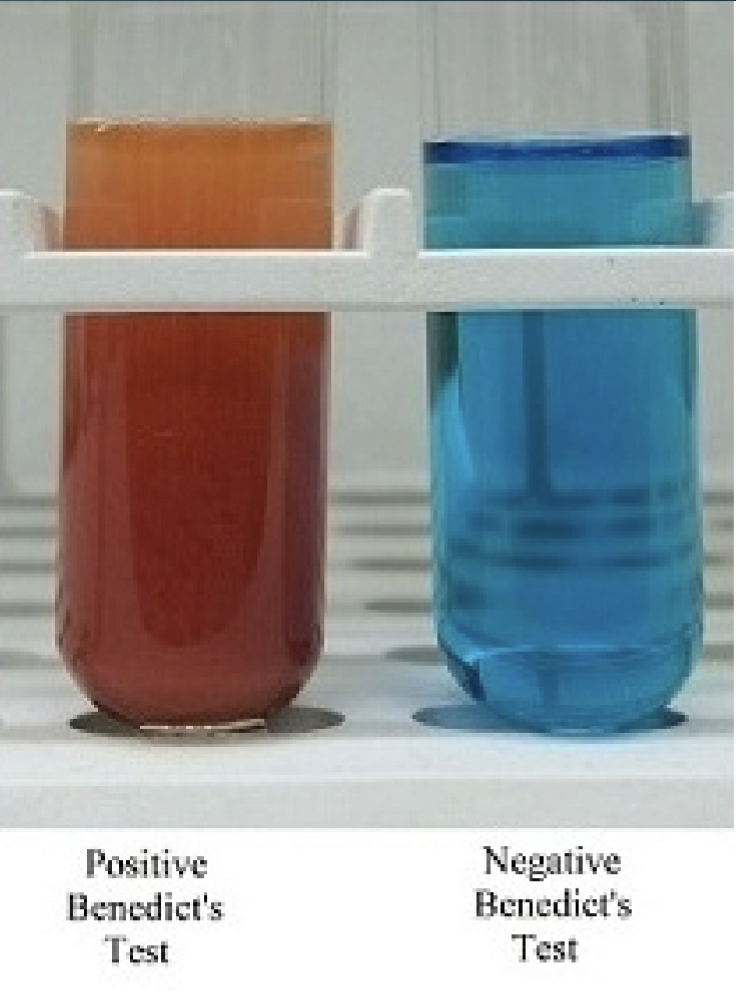<p>Benedict’s Test</p><ul><li><p>glucose pos (+): red</p></li><li><p>glucose neg (-): blue</p></li></ul><p></p>