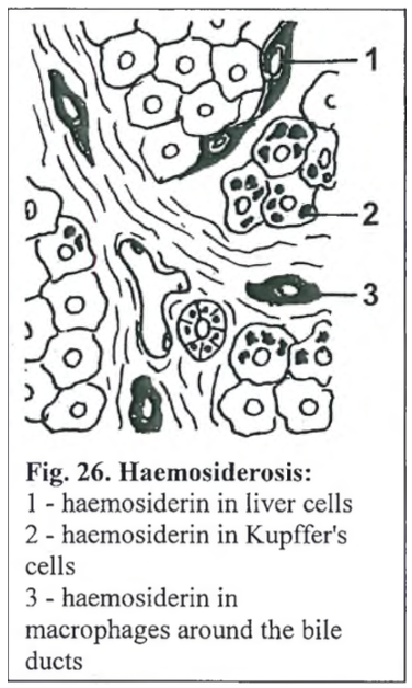 <p><strong>Hemosiderosis of spleen</strong> (Liesegang)</p>