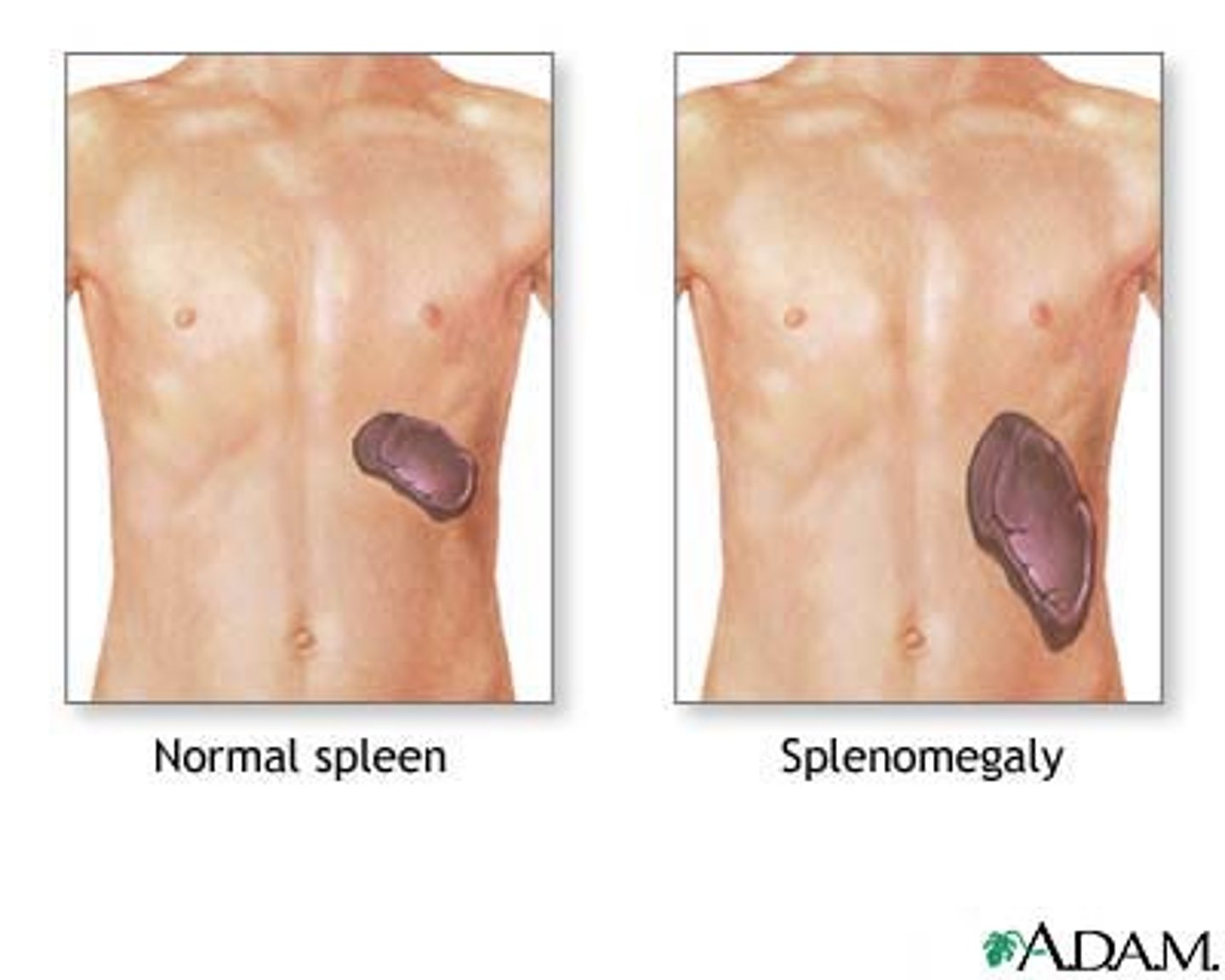 <p>defined by an area of dullness exceeding 7 cm. When enlarged, the spleen progresses downward and toward the midline.</p>
