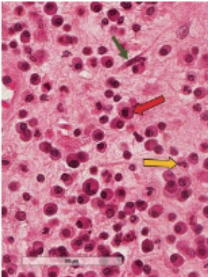 <p>what is this (yellow arrow) </p>