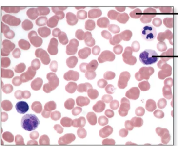 <p>What are the types of blood cells?</p>