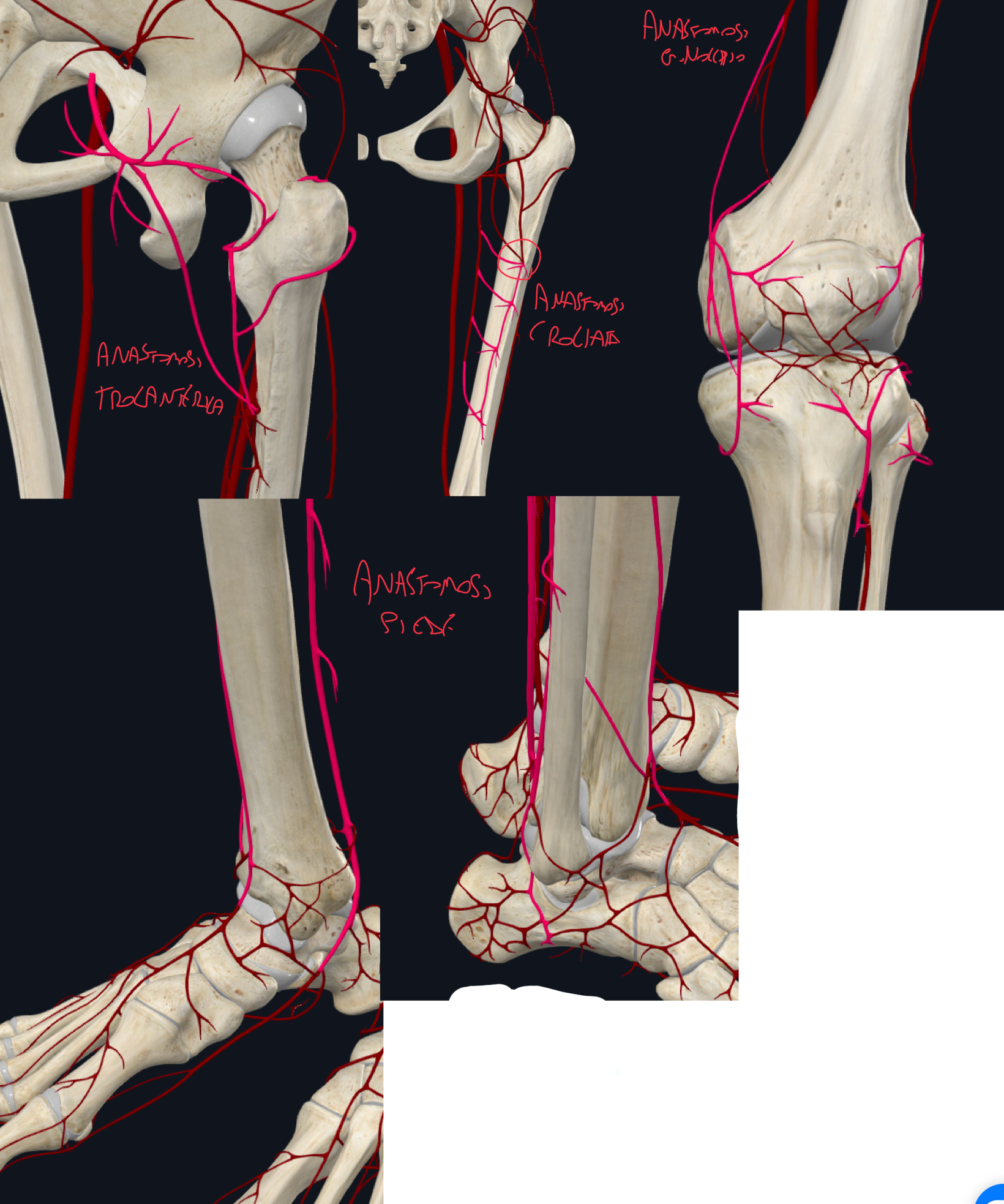 <p>ANASTOMOSI DELL’ANCA comprende: </p><ul><li><p>Anastomosi trocanterica coinvolge → arteria glutea superiore e inferiore (della iliaca interna), arteria circonflessa mediale e laterale del femore (della femorale)</p></li><li><p>Anastomosi crociata coinvolge → arterie perforanti, circonflessa mediale e laterale della femorale profonda, glutea inferiore della iliaca interna</p></li></ul><p>ANASTOMOSI DEL GINOCCHIO:</p><ul><li><p>Dall’arteria poplitea originano:</p><ul><li><p>Arterie Genicolari Superiori Mediali e Laterali</p></li><li><p>Arteria Genicolare Media</p></li><li><p>Arterie Genicolari Inferiori Mediali e Laterali</p></li></ul></li><li><p>Queste si anastomizzano con:</p><ul><li><p>Arteria Tibiale Ricorrente</p></li><li><p>Arteria Fibulare Circonflessa</p></li></ul></li><li><p>Questo garantisce il flusso durante la flessione del ginocchio.</p></li></ul><p>ANASTOMOSI DEL PIEDE:</p><ul><li><p>Tra le Arterie Tibiale Anteriore e Posteriore, e Fibulare</p></li><li><p>Forma la rete arteriosa malleolare mediale-laterale, e la rete arteriosa calcaneale</p></li></ul><p></p>