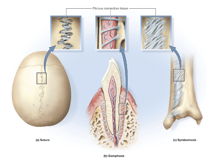<p>gomphosis</p>