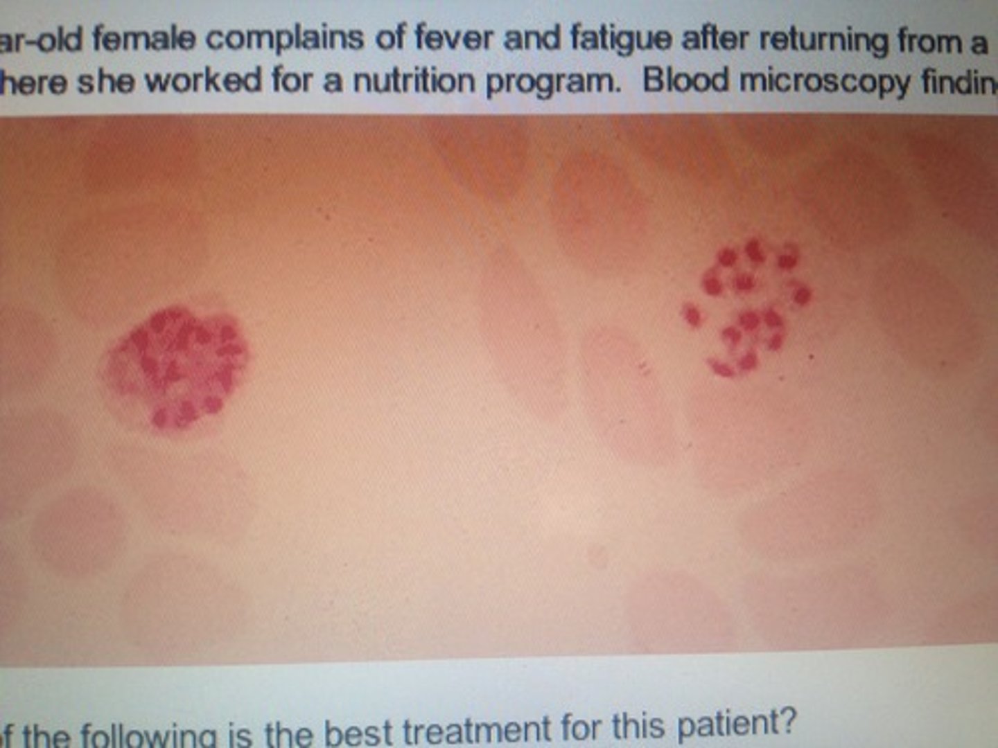 <p>blood smear. Tx?</p>