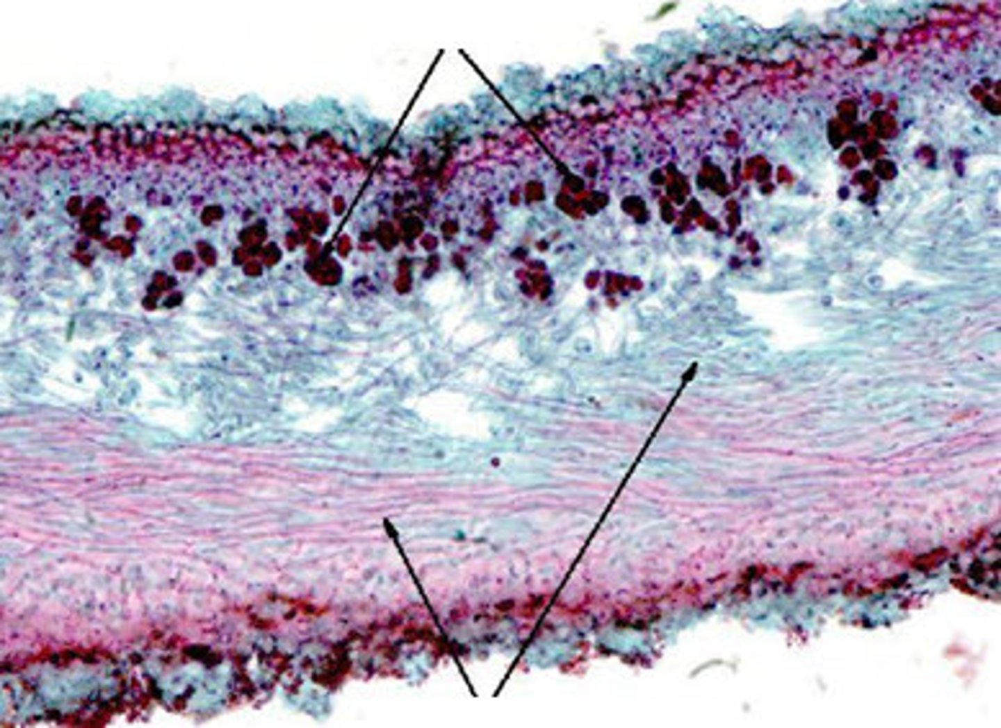 <p>photosynthetic part of lichen (cyanobacteria or green algae)</p>