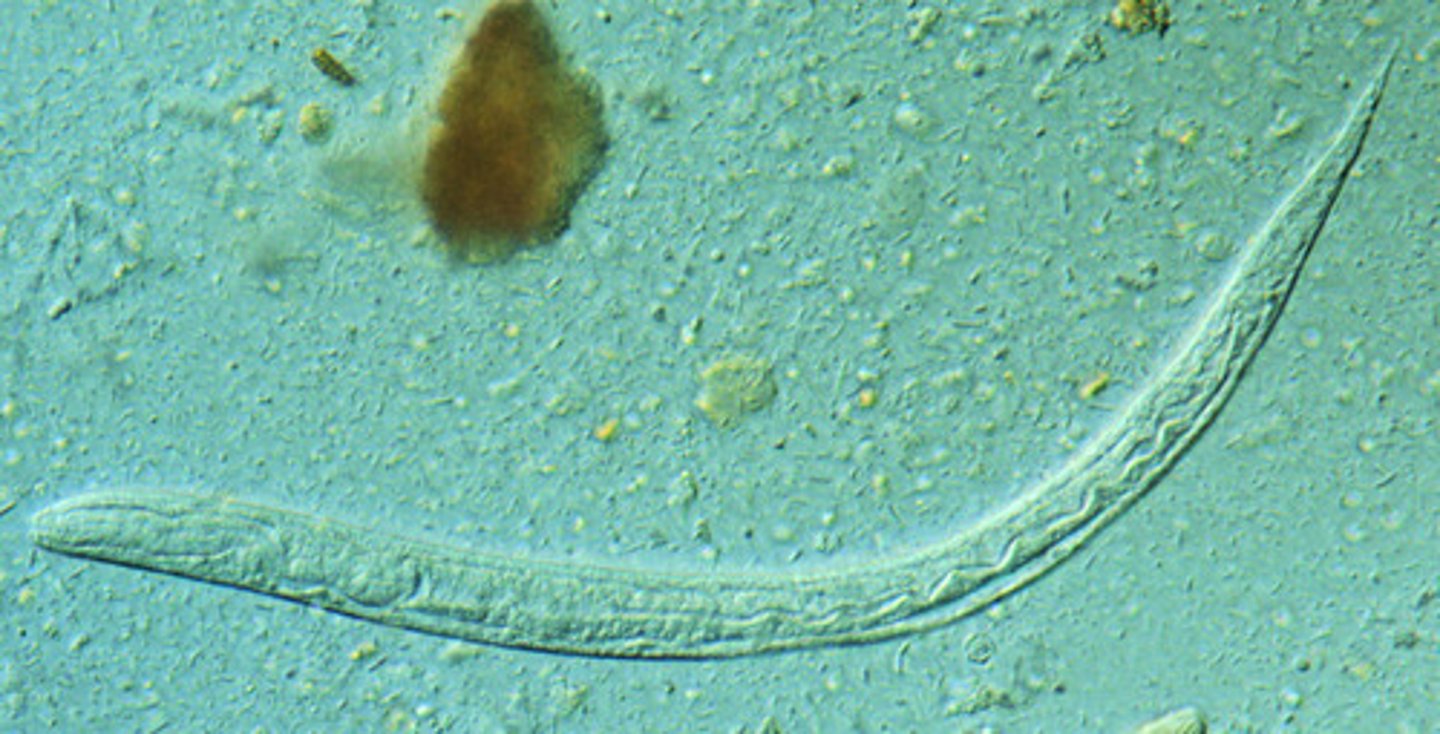 <p>Strongyloides stercoralis</p><p>3 multiple choice options</p>