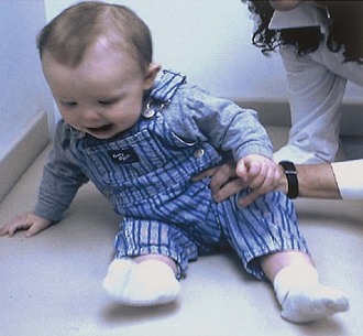 <p><strong>Middle Infancy, 4-6 mo:</strong> Equilibrium Reaction</p>