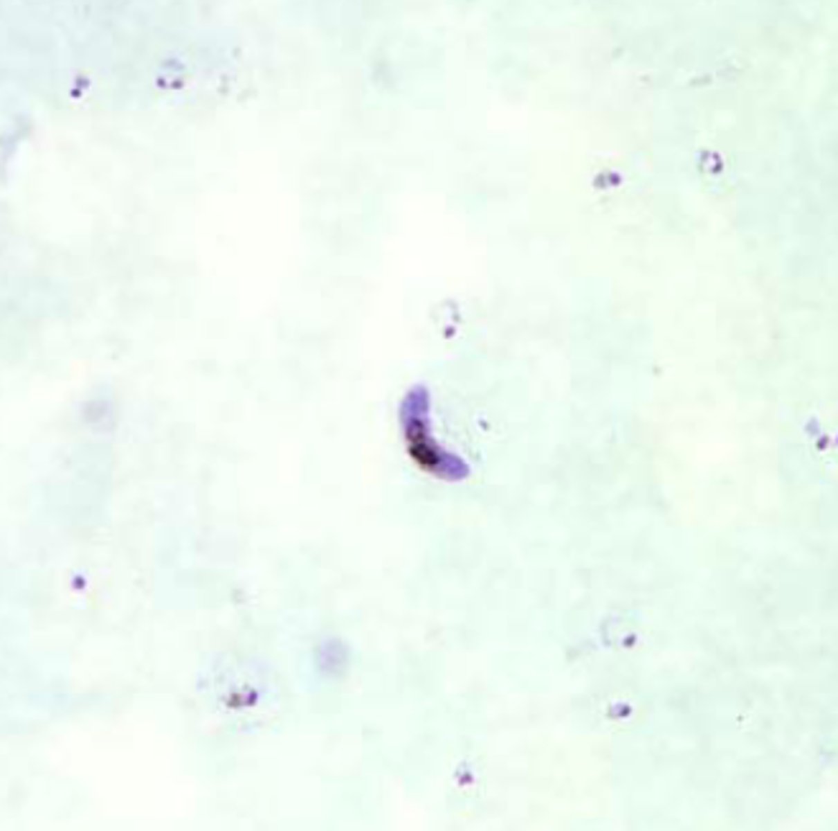 <p>no RBCs, thick smear</p>
