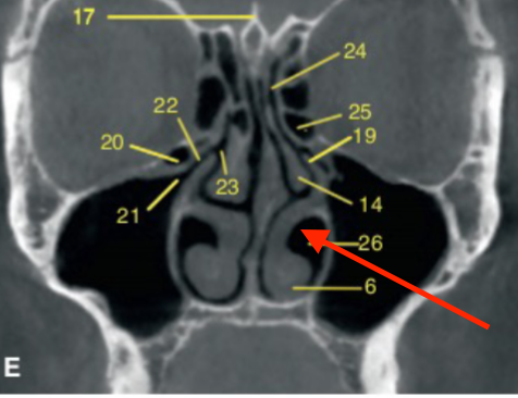 <p>identify structure </p>