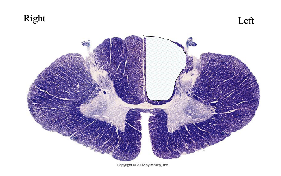 <p>What clinical findings would you expect with each of these lesions?</p>