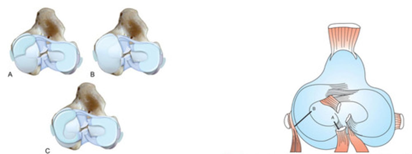 <p>Although overall controversial and we don't know what is best, what are the two treatments for meniscal injuries? Both of these treatments can lead to what?</p>