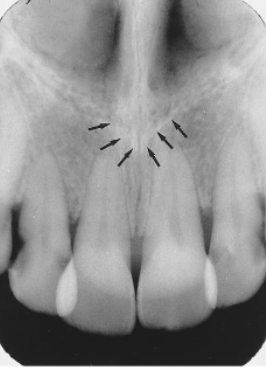<p>identify the structure</p>
