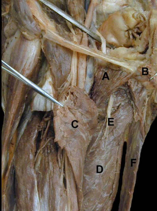<p>C</p>