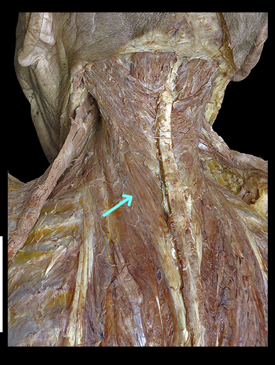 <p>Structure</p>