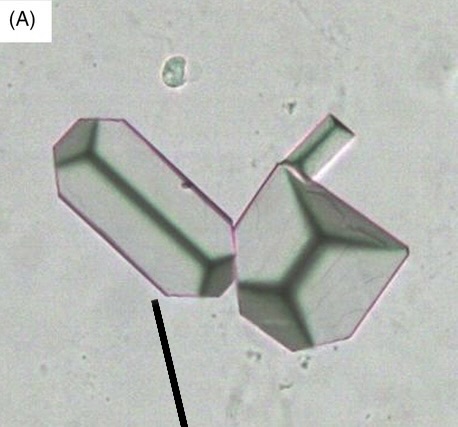 <ol><li><p>Identify pointed structure.</p></li><li><p>What is this structure made up of?</p></li></ol><p></p>