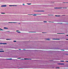 striations, many nuclei