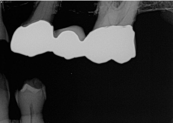 <p>What is the problem with this Overexposed Receptor X-ray?</p>
