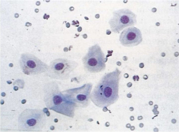 <p><span>•Parabasal epithelial cells predominate</span></p><p><span>•RBCs are present in large numbers</span></p><p><span>•A small number of neutrophils may be present</span></p><p>What stage of the estrous cycle is found via the vaginal cytology?</p>