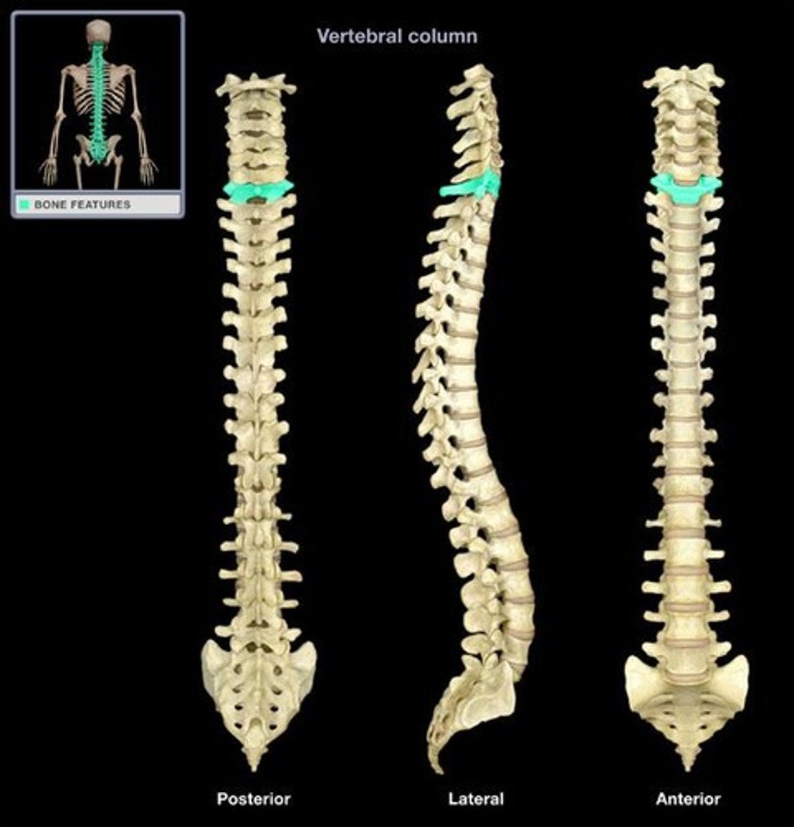 <p>The spinous process of C7, which is visible through the skin at the base of the neck and is the landmark for counting the vertebrae.</p>