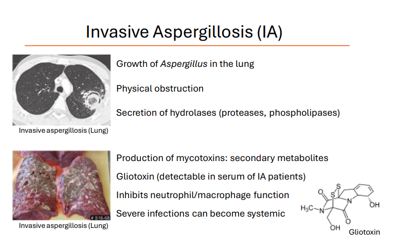<ul><li><p>Growth of Aspergillus in the lung - big as a tangerine</p></li><li><p><strong>Physical obstruction</strong></p></li><li><p>Secretion of hydrolases (proteases, phospholipases)</p></li><li><p>Production of mycotoxins: secondary metabolites - bad impacts on the human body</p></li><li><p><strong>Gliotoxin </strong>(detectable in serum of IA patients) → <strong>Inhibits neutrophil/macrophage function</strong></p></li><li><p>Severe infections can become <strong><u>systemic</u></strong></p></li></ul><p></p>