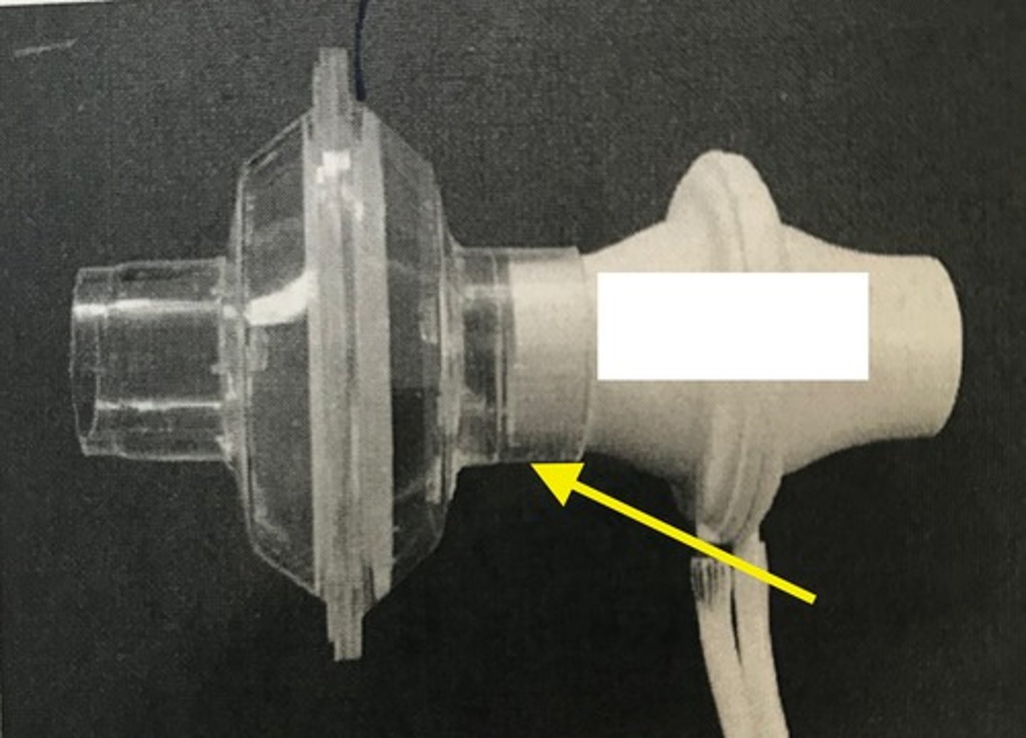 <p>What is the yellow pointing to?</p>