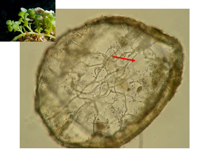<p>What is the name of the structure indicated by the pointer?</p><p>Rhizoid</p><p>Trabeculae</p><p>Ultricle</p><p>Siphon</p>
