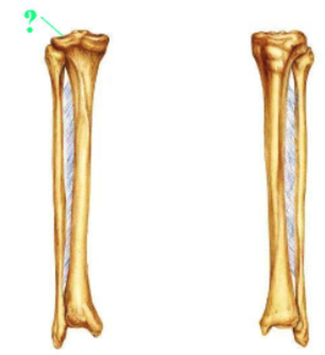 <p>articular surface of lateral condyle</p>
