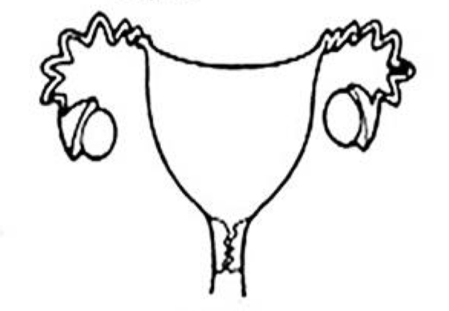<p>Which uterine classification is this?</p>