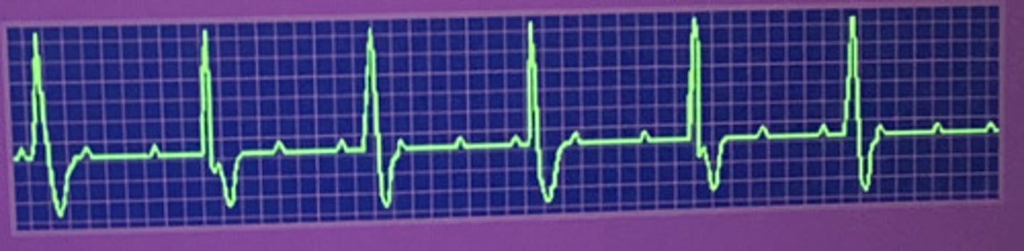 <p>third degree</p>