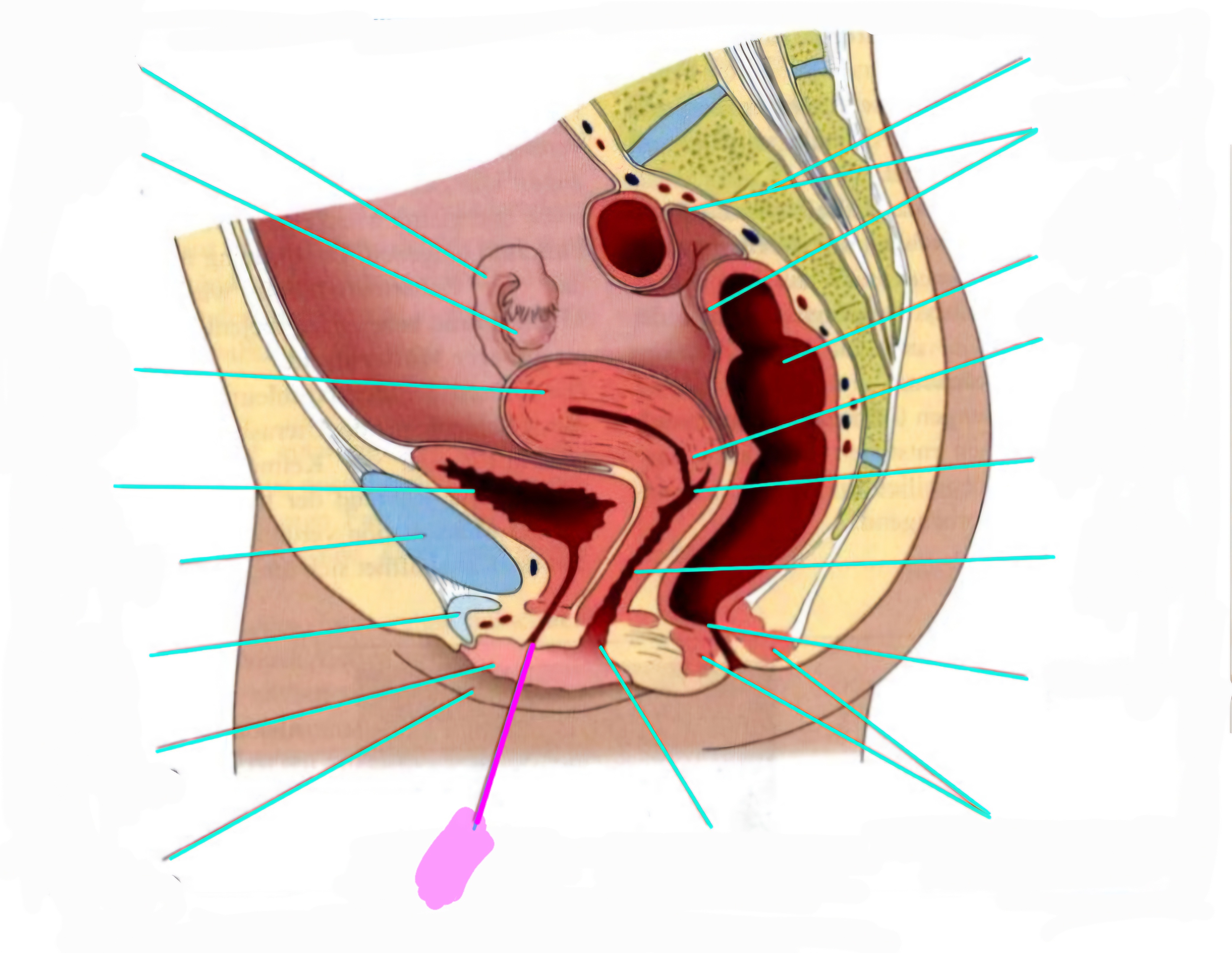 term image
