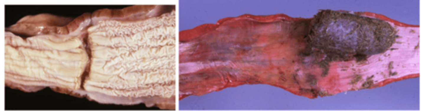 <p>- Ingestion of large materials (potatoes, apples, etc), or impacted feed</p><p>- Can cause circumferential scarring on mucosa</p>