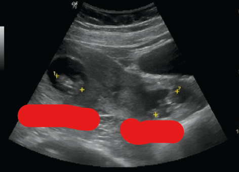 <p>what is shown?</p>