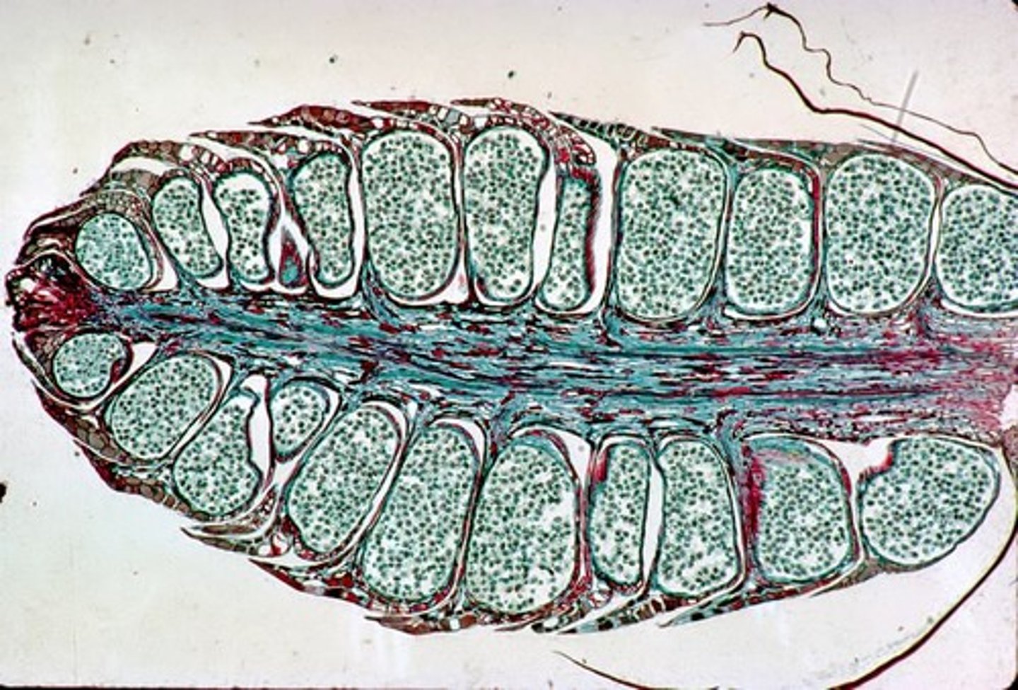 <p>Aggregated megasporophylls, also known as ovuliferous scales.</p>