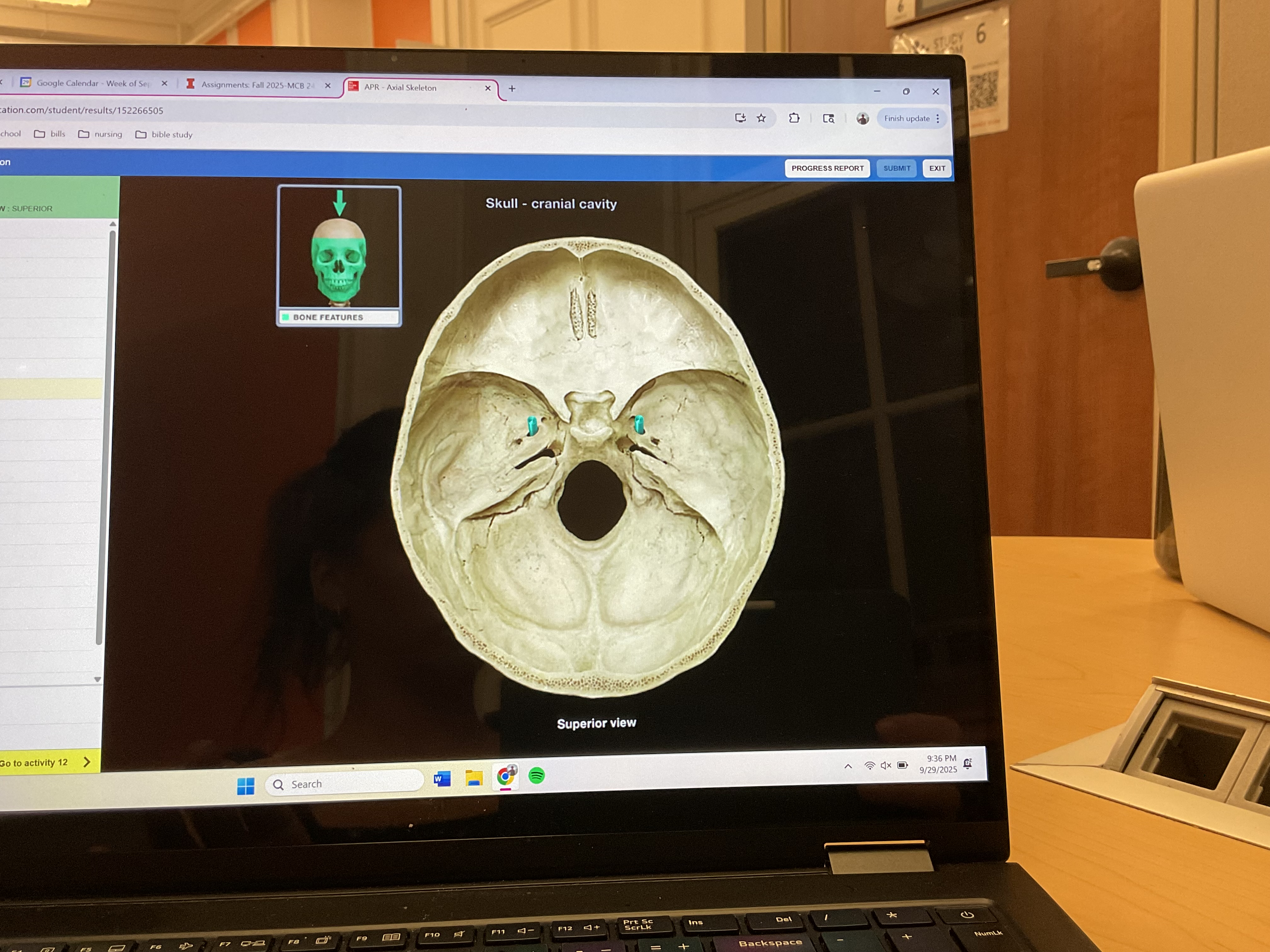 <p>Foramen ovale </p>